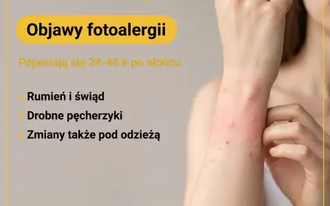 Objawy fotoalergii: rumień, świąd, drobne pęcherzyki pojawiające się po słońcu, nawet pod ubraniem.