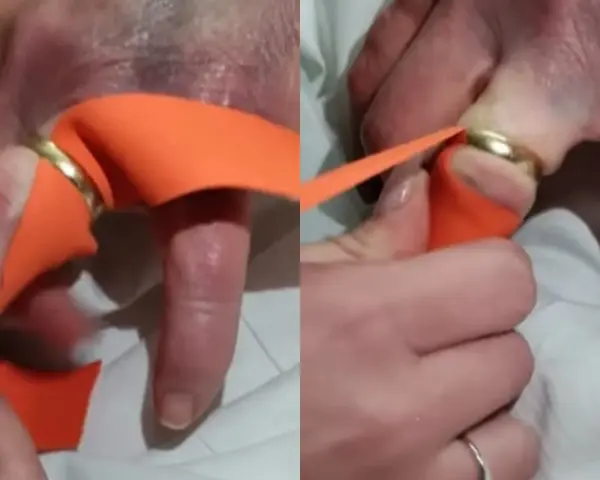 Pomoc w zdjęciu za ciasnej obrączki z palca przy użyciu pomarańczowej taśmy.
